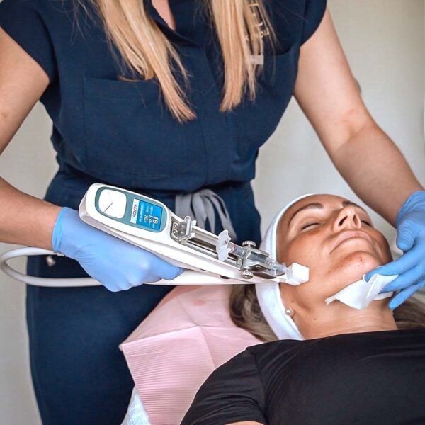Vampire Facial PRP – Image 2