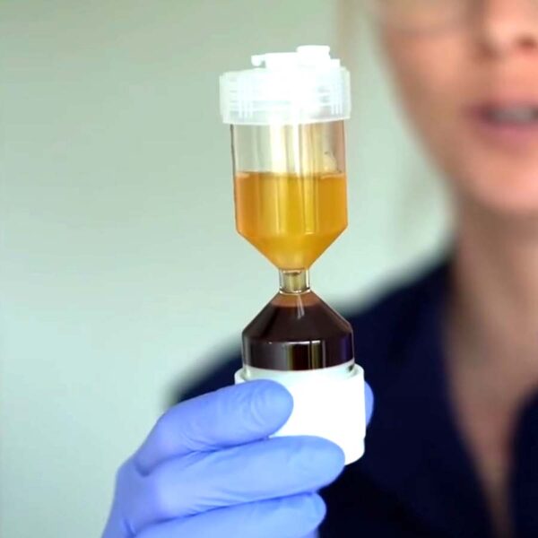 Vampire Facial PRP – Image 3